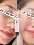 Cách Để Hết Mụn Mờ Thâm Nhanh Nhất Với Serum More Pas Qua Nhật Bản 9